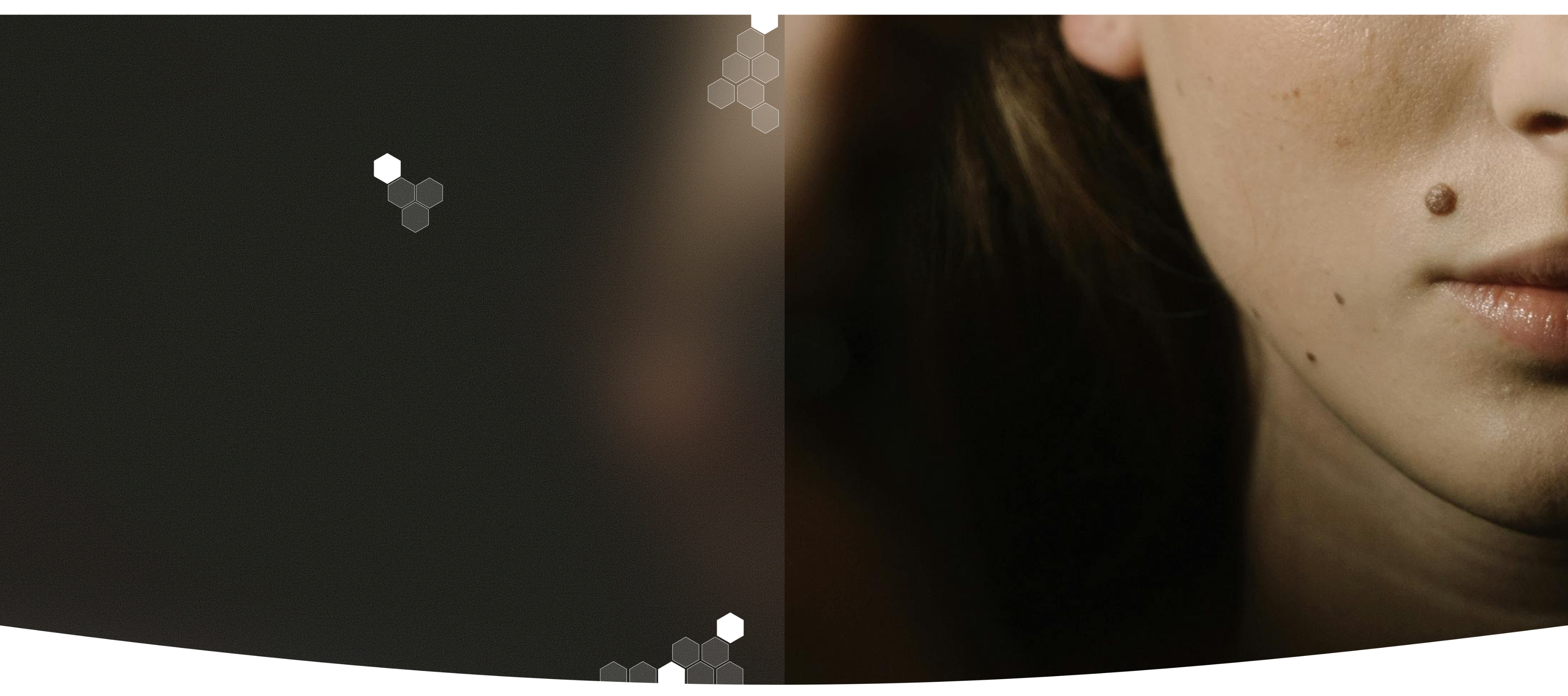 Grains de beauté examen dermatologique